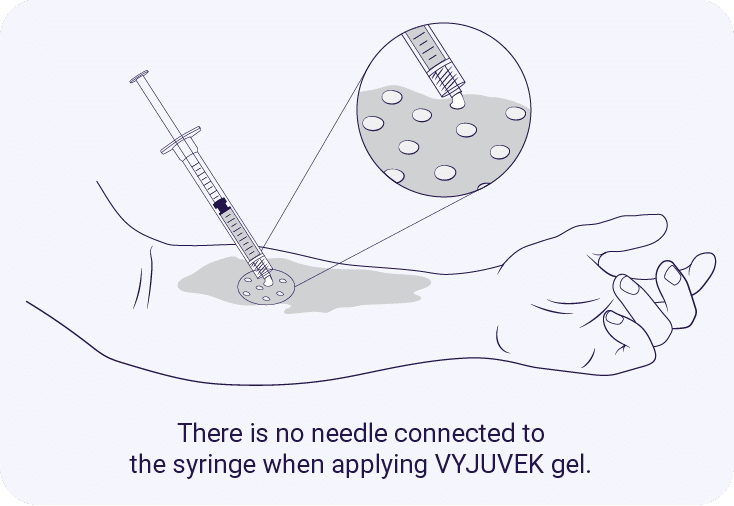 VYJUVEK® topical application to skin wounds